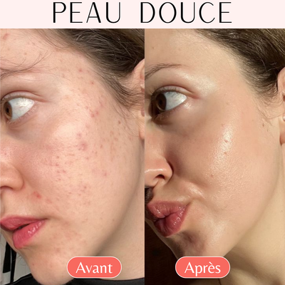 501 Original™ – Soin douche illuminateur